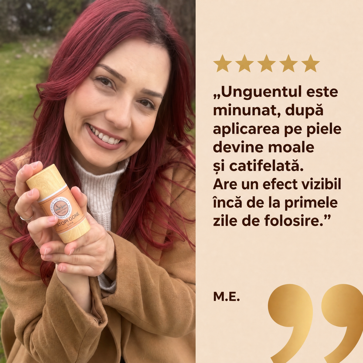Testimonial__mehlem-pri-atopichen-dermatit-atopi-gone__Testimonial_png.png